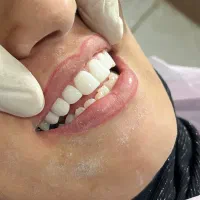 جشنواره دندانپزشکی با اقساط ویژه|خدمات آرایشگری و زیبایی|قم, شهرک فاطمیه|دیوار