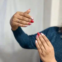 کاشت اولیه و ترمیم با قیمت ویژه