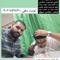 فصد پیشانی