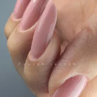 خدمات کاشت و ترمیم