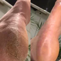 پدیکور و کفسابی اسپا vip