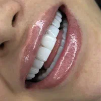 دندانپزشکی اقساطی با وام قرض الحسنه|خدمات آرایشگری و زیبایی|اصفهان, لاله|دیوار