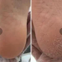 پدیکور و کفسابی پارافین تراپی|خدمات آرایشگری و زیبایی|گلبهار, شهر جدید گلبهار|دیوار