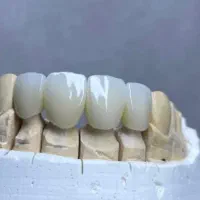 انجام کلیه خدمات دندانپزشکی ویژه