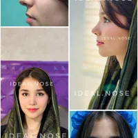 جشنواره عمل زیبایی بینی با تخفیف ویژه|خدمات آرایشگری و زیبایی|سقز, |دیوار