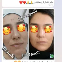 پوست هلویی زیبا بدون تزریق|آرایشی، بهداشتی، درمانی|اراک, |دیوار