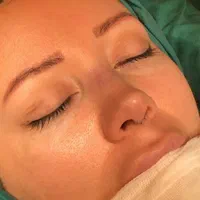 عمل جراحی زیبایی بینی،لیفت صورت،گوش|خدمات آرایشگری و زیبایی|تهران, تهرانپارس غربی|دیوار
