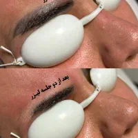 پاک کردن تتو با لیزر کیوسوییچ تضمینی|خدمات آرایشگری و زیبایی|تهران, نیروی هوایی (پیروزی)|دیوار