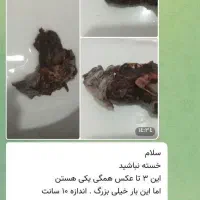 مشاوره داوطلبانه کیست سینه ورحم،تنبلی،تخمدان،