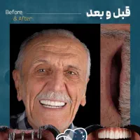 دندانپزشکی/ مرکز ایمپلنت دیجیتال 6800|خدمات آرایشگری و زیبایی|تهران, پاسداران|دیوار