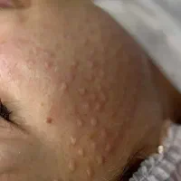 مرکز زیبایی با بروزترین دستگاه های روز دنیا|خدمات آرایشگری و زیبایی|ماهدشت, |دیوار