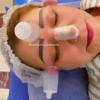دیسک سیاتیک دیسک کمر و‌گردن حجامت