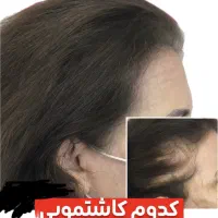 خداحافظی با کمپشتی مو با جدیدترین روش بدون دردوخون