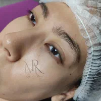 میکروبلیدینگ ابرو