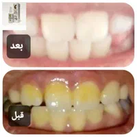 پک مراقبت دهان و دندان اولترانامل اورجینال