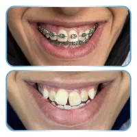 تمامی خدمات دندانپزشکی با بهترین کیفیت و اقساطی|خدمات آرایشگری و زیبایی|ماکو, |دیوار