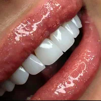 کامپوزیت دندان فکی ۵ت  نانو سرامیک لبه شفاف