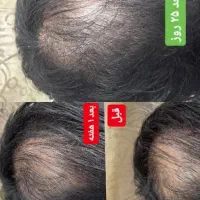 درمان انواع مشکلات پوست و مو