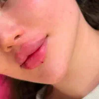 ژل و بوتاکس/ ژل لب/کانتورینگ عربی/روسی|خدمات آرایشگری و زیبایی|فردیس, فردیس|دیوار