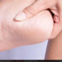 راهنمایی در مورد خار پاشنه