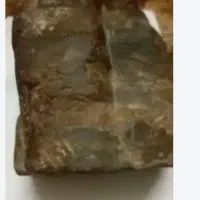 سنگ مرهم