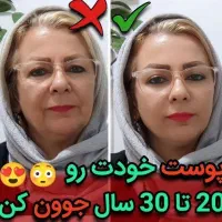 فروش. محصولات پوست و مو جوانساز ضد لک ضد جوش