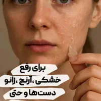 کرم جوانه گندم اصل|آرایشی، بهداشتی، درمانی|چالوس, |دیوار