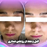 پاکسازی تخصصی پوست صورت|خدمات آرایشگری و زیبایی|اصفهان, فرح آباد|دیوار
