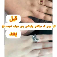 کرم سفید کننده صورت|آرایشی، بهداشتی، درمانی|میناب, |دیوار
