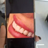 دستیار دندانپزشکی