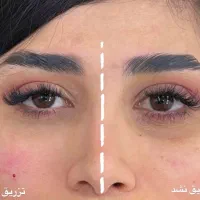 ژل،بوتاکس،چربی سوز،جوانساز|خدمات زیبایی و سلامت|اهواز, کیانپارس |دیوار