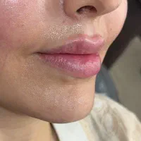 ژل لب باقیمت نجومی