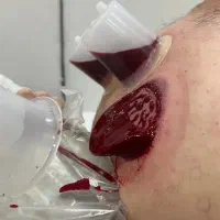 حجامت. بادکش درمانی. زالو درمانی|خدمات آرایشگری و زیبایی|یاسوج, |دیوار