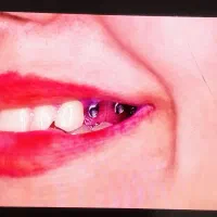مرکزفوق تخصصی ایمپلنت دیجیتال/سبک کاخ لبخند/یکروزه|خدمات زیبایی و سلامت|مشهد, احمدآباد|دیوار