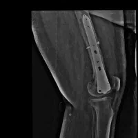 عکس رادیولوژی در منزل|پزشکی|تهران, پاسداران|دیوار