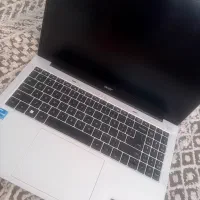 Acer aspire lite 16 ال سی دی نیاز به تعویض دارد