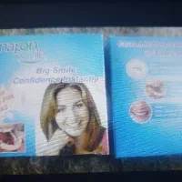 لمینت متحرک دندان اسنپ اسمایل