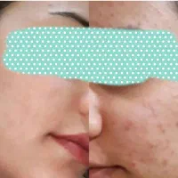 مثل کره چربی بسوزون و به اندام ایده آلت برس|آرایشی، بهداشتی، درمانی|جیرفت, |دیوار