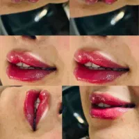 تخفیفات ژل ، بوتاکس و مزوژل فقط تا یک هفته