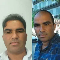 کاشت مو پرتراکم کاشت ابرو طبیعی