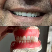 دندان مصنوعی تخصص ماست ( اقساط )|خدمات آرایشگری و زیبایی|اصفهان, لاله|دیوار