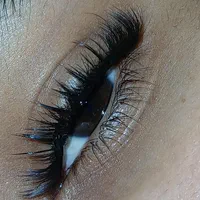کاشت مژه