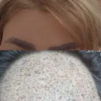 کاشت مو ، ابرو و ریش دائم کاملا تخصصی