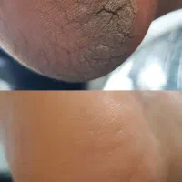 پدیکور تخصصی۳۰درصد تخفیف با معرفی نفر دوم|خدمات آرایشگری و زیبایی|شیراز, مسلم|دیوار