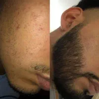 چیزی روی صورتت نیست