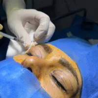 تخفیف ویژه شب یلدا برای جراحی بلفاروپلاستی|خدمات آرایشگری و زیبایی|مسجد سلیمان, |دیوار