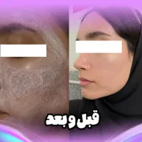 فیشال و پاکسازی پوست
