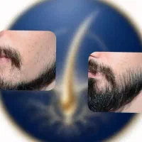 یکبار برای همیشه سلام به موی پرپشت