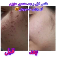 مشاورتخصصی پوست ومو|خدمات آرایشگری و زیبایی|شیراز, دارالرحمه|دیوار