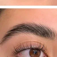 لیفت ابرو  اصلاح صورت